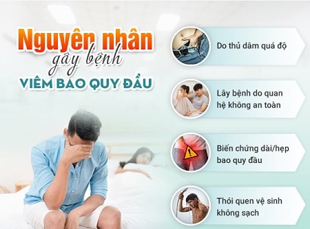 12 địa chỉ khám viêm bao quy đầu ở đâu an toàn tốt nhất Hà Nội